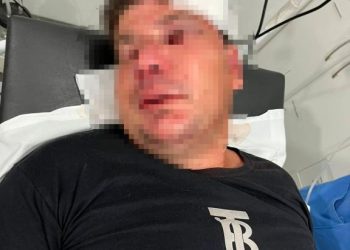 Homem espanca sobrinho que tentou estuprar sua filha em São João Batista